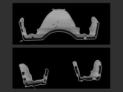 Surface determination on extracted ROIs