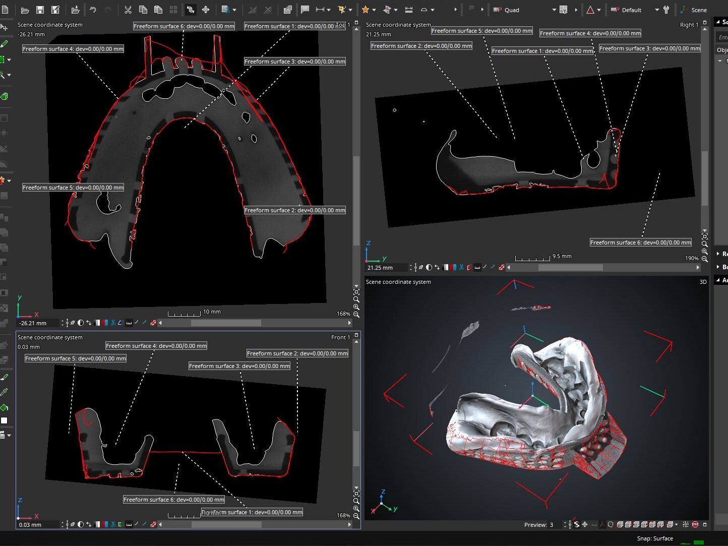 Creating and dilating ROI from each volume