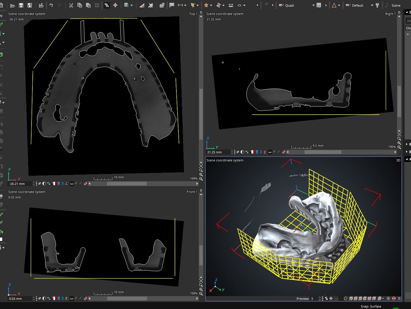 Importing measurement template with freeform surfaces on lower section