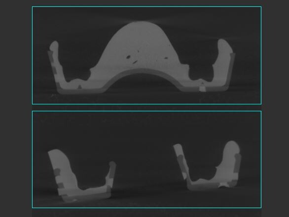 Software shot of a template with two ROIs of the horseshoe tray