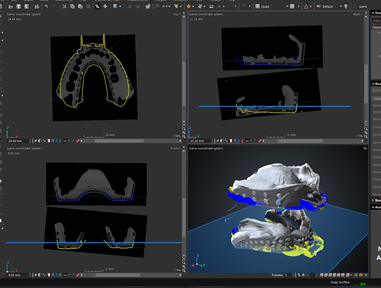 Best-fit registration aligns against imported horseshoe meshes