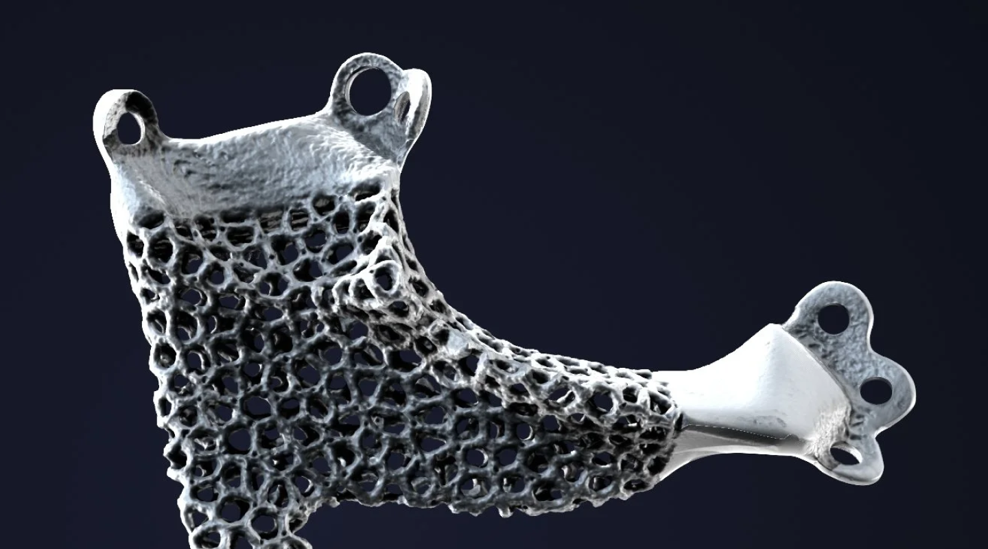 Additive Manufacturing Meets Medical Implants Additive Manufacturing Meets Medical Implants